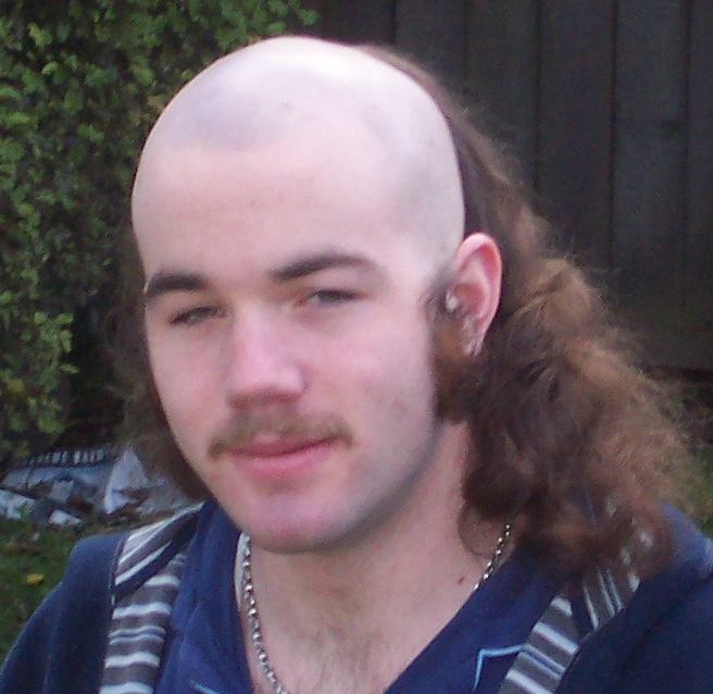 Peinado Skullet. Cabeza rapada a cero con partes largas. Es asqueroso !